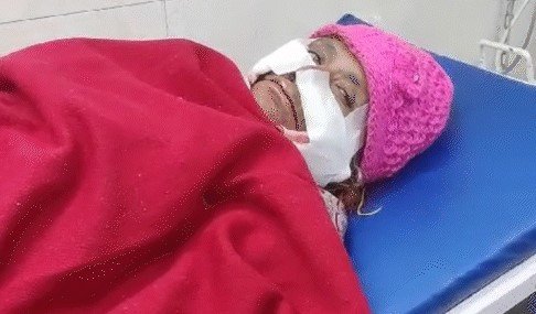 Panipat में बुजुर्ग महिला को कुत्ते ने 19 जगह काटा, गंभीर हालत में महिला अस्पताल में भर्ती 2 dog bit an elderly woman at 19 places