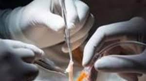 Gurugram में किडनी रैकेट का भंडाफोड़, CM Flying टीम ने की Hotel पर रेड, Bangladeshi युवक किया काबू 2 Kidney racket busted in Gurugram - 2