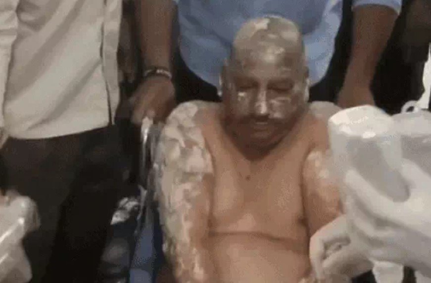 Fatehabad में ब्लास्ट, दुकान के बाहर रखा Oxygen Cylinder फटने से लगी आग, 3 झुलसे 2 Blast in Fatehabad - 2