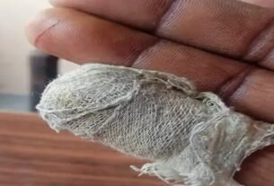 shopkeeper's finger was cut