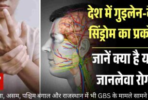 गुइलेन बैरे सिंड्रोम का प्रकोप