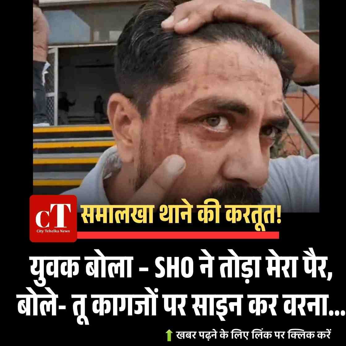 समालखा थाने की करतूत! युवक बोला – SHO ने तोड़ा मेरा पैर, बोले- तू कागजों पर साइन कर वरना…