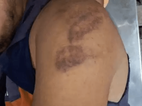 प्राइवेट पार्ट में डाला डंडा, हरियाणा में थाने में दलित युवक से दरिंदगी का आरोप 4 image 15